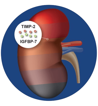 Kidney Illustration